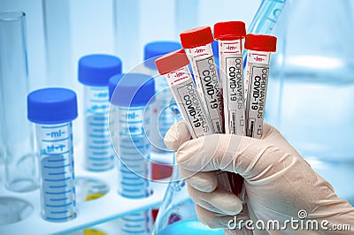 A hand wearing a white latex glove and holding a coronavirus test kit. Pandemic infectious concept Stock Photo