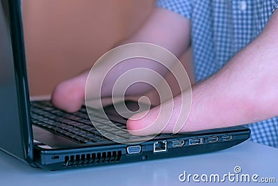 Disabled man with amputated two stump hands is typing on laptop, closeup view. Stock Photo