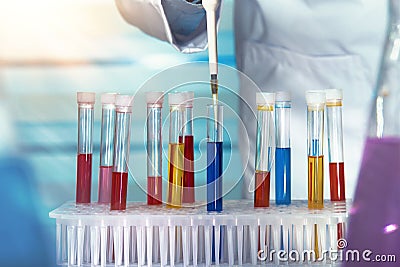 Hands of a researcher pipetting samples of fluids in tubes test Stock Photo