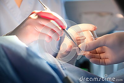 Hands of the surgeon of the dentist and the assistant in protective gloves with the instrument Stock Photo