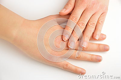 Hands touching with dry skin Stock Photo