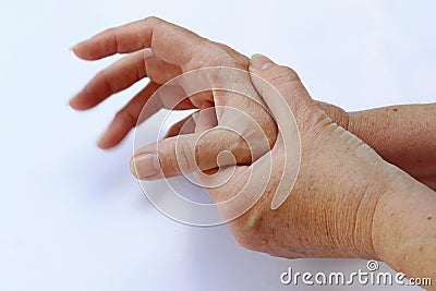 The hands of a woman with Parkinson`s disease tremble very strongly Stock Photo