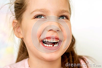 A happy girl t-shirt without a front tooth laughs. Isolated on a white background. Stock Photo