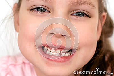 A happy girl school- age t-shirt without a front tooth laughs. Isolated on a white background. Stock Photo