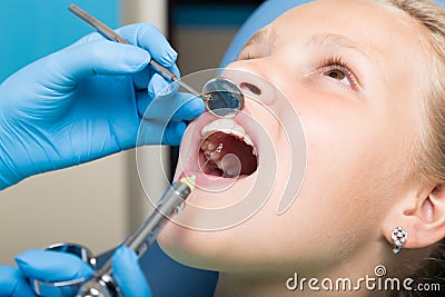 Happy little girl with open mouth undergoing dental treatment at clinic. Dentist checked and curing teeth a child Stock Photo