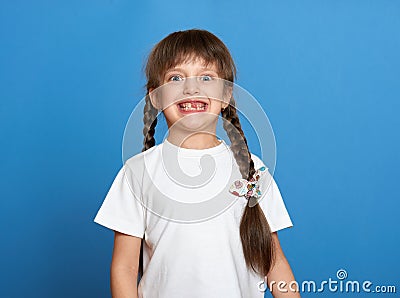 Happy lost tooth girl portrait, studio shoot on blue background Stock Photo