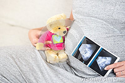 Happy pregnant woman sitting on sofa at home hand holding bear d Stock Photo