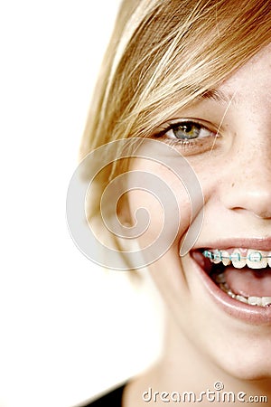 Happy Teen with Braces Stock Photo