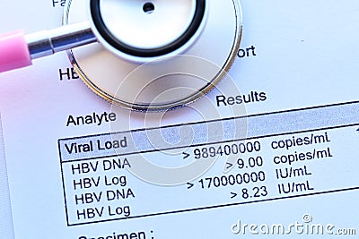 HBV viral load results Stock Photo