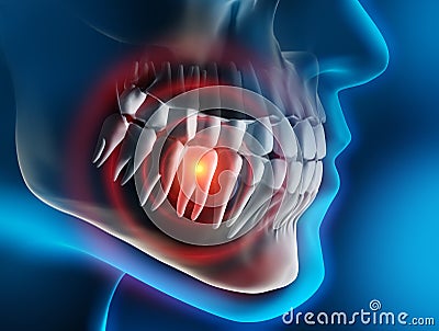 Head and jaw with pain in a tooth against a blue backdrop Cartoon Illustration