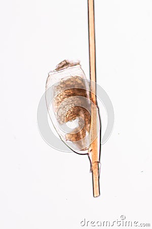 The head louse Pediculus humanus capitis is a parasite. Stock Photo