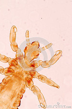 The head louse Pediculus humanus capitis is a parasite Live on the body. Stock Photo