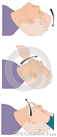 Head position for open airway Vector Illustration