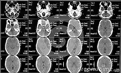 Head scan Stock Photo