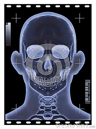 Head X-ray Cartoon Illustration