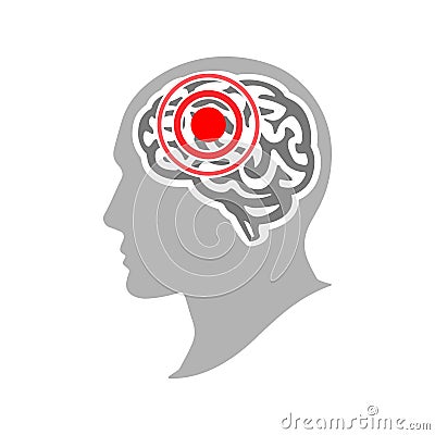 Headache and migraine concept. Silhouette of a human head with a headache. Brain disease. Vector illustration Vector Illustration