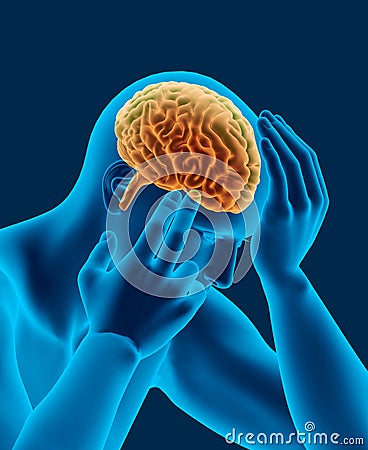 Headache x-ray scan of human head with brain side view Stock Photo