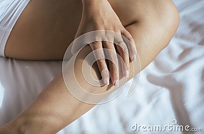 Health allergy skin care problem,Woman with rash or papule on her leg from allergies Stock Photo