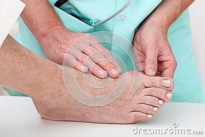 Health problems - Hallux Stock Photo