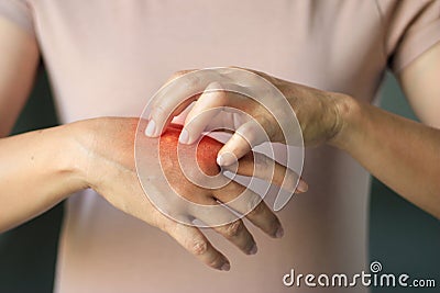 Healthcare and medical concept. Female scratching itch on her hand. Stock Photo