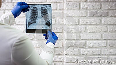 A healthcare professional examines the chest film. Chest x-ray of a person in the hands of a doctor, x-ray of the lungs. Stock Photo