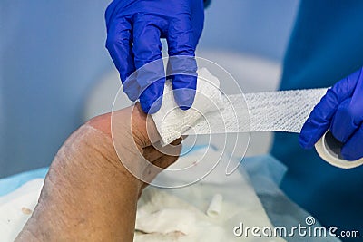 Healthcare worker nursing toe with bandage gauz after ingrown toenail surgery Stock Photo