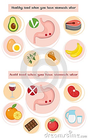 Healthy and avoid food if you have stomach ulcer infographics. Prevention of stomach diseases. Medicine concept. Vector Vector Illustration