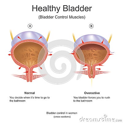 Healthy bladder in women. Stock Photo