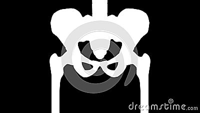 Bone Osteoporosis Animation Stock Video - Video of anatomy, animation:  84531079