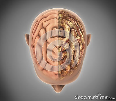 The Healthy Brain and The Unhealthy Brain Stock Photo