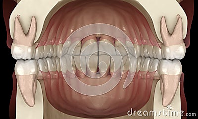 Healthy human teeth with normal occlusion, 3D Illustration Stock Photo