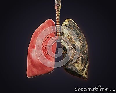 Healthy Lung and Smokers Lung Stock Photo