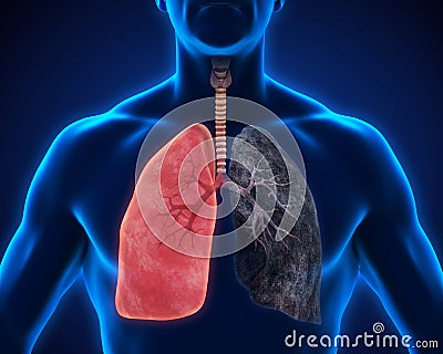 Healthy Lung and Smokers Lung Stock Photo