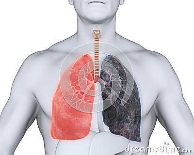 Healthy Lung and Smokers Lung Stock Photo