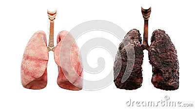 Healthy lungs and disease lungs on white isolate. Autopsy medical concept. Cancer and smoking problem. Stock Photo