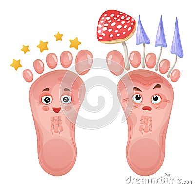 Healthy and problem foot characters. Skin or nail fungus. Pair of funny human leg. Treatment fungal infection. Vector Vector Illustration