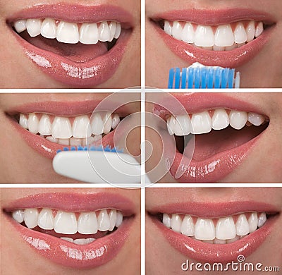 Healthy Teeth Stock Photo