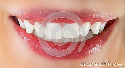 Healthy teeth Stock Photo