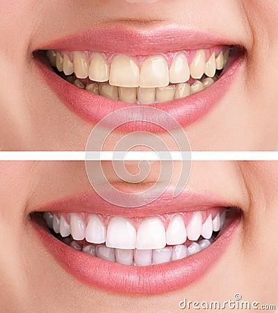 Healthy teeth and smile Stock Photo