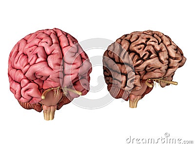 A healthy and unhealthy brain Cartoon Illustration