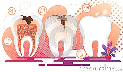 Healthy and Unhealthy Teeth Stand in Raw. Decay. Vector Illustration