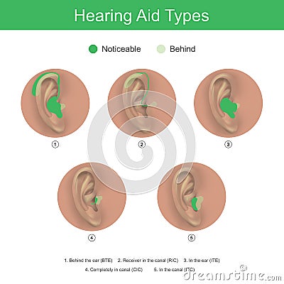 Hearing Aid Types. Health care products. Stock Photo