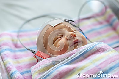 Hearing test of a sleeping newborn at hospital Stock Photo