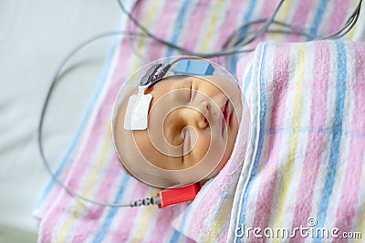 Hearing test of a sleeping newborn at hospital Stock Photo