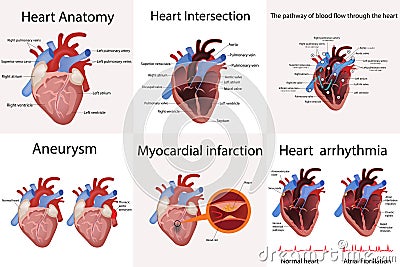 Heart anatomy and types of heart disease vector illustration Vector Illustration