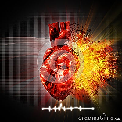 Heart attack Stock Photo