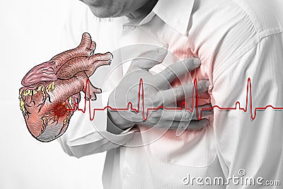 Heart attack and heart beats cardiogram Stock Photo