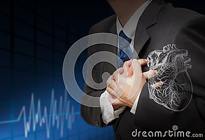 Heart Attack and heart beats cardiogram Stock Photo