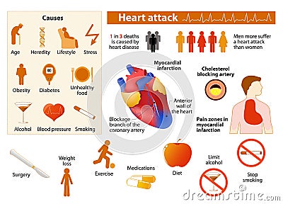 Heart attack infographic Vector Illustration
