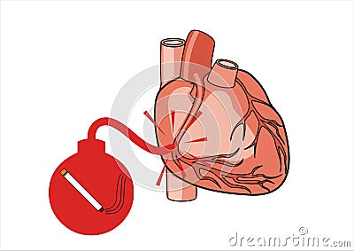 Heart Attack Risk Cartoon Illustration
